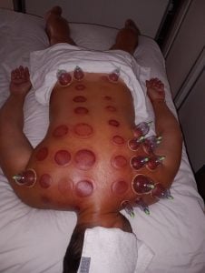 Massoterapeuta — foto 3