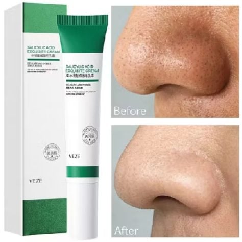 20ml De Creme De Ácido Salicílico Para Remoção De Poros/Acne E Iluminador/Limpeza/Controle