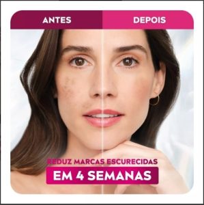 Creme Facial Nívea Cellular Luminous 630 Anti-manchas. — foto 6