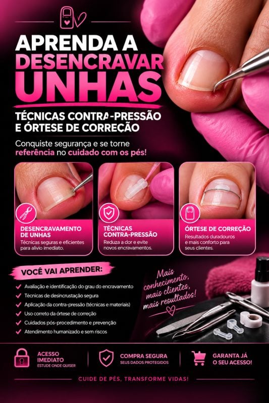 Ebook Aprenda A Desencravar Unhas ,técnicas Contra-pressão E órtese De Correção