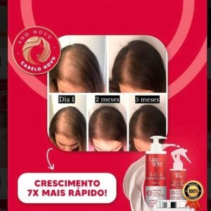 Kit S.O.S crescimento — foto 6