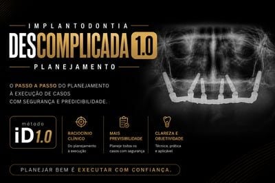 Implantodontia Descomplicada 1.0 - VÍDEO AULAS (CIRURGIAS E PRÓTESES)