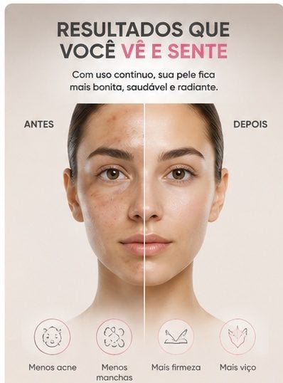 **Máscara Facial LED com 7 Cores Fototerapia para Rejuvenescimento, Clareamento e Poros — foto 2