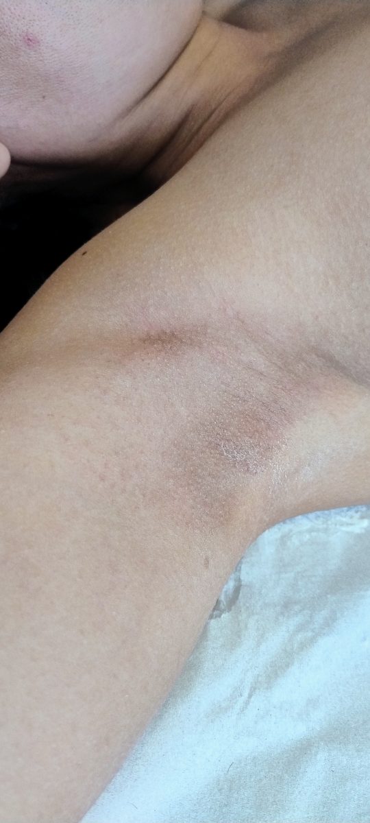 Depilação com cera quente — foto 2