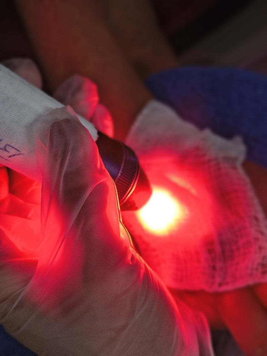 Curativos Domiciliares E Laserterapia Nova Iguaçu E Região — foto 2