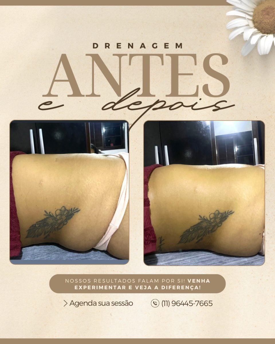 Realce sua beleza com tratamentos personalizados! Drenagem Massagens — foto 2