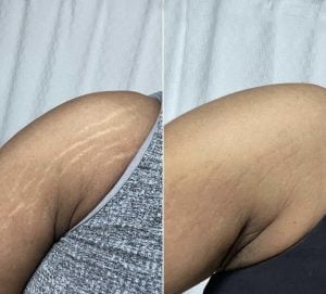 Realce sua beleza com tratamentos personalizados! Drenagem Massagens — foto 4