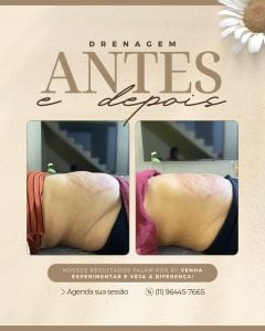 Realce sua beleza com tratamentos personalizados! Drenagem Massagens — foto 5