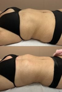 Realce sua beleza com tratamentos personalizados! Drenagem Massagens — foto 7