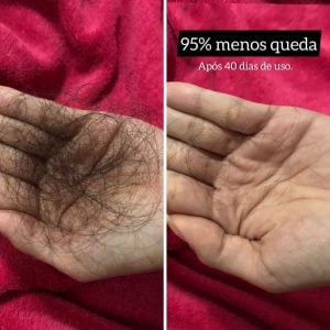 KITi SOS Crescimento Rápido Capilar — foto 3