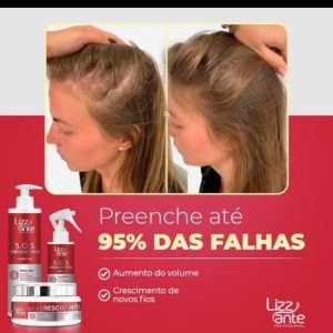 Kit S.O.S crescimento — foto 4