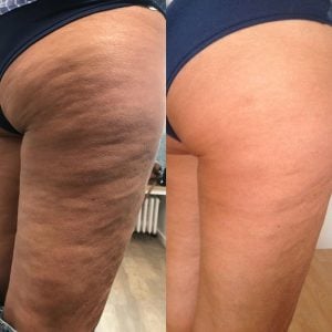 Realce sua beleza com tratamentos personalizados! Drenagem Massagens — foto 6